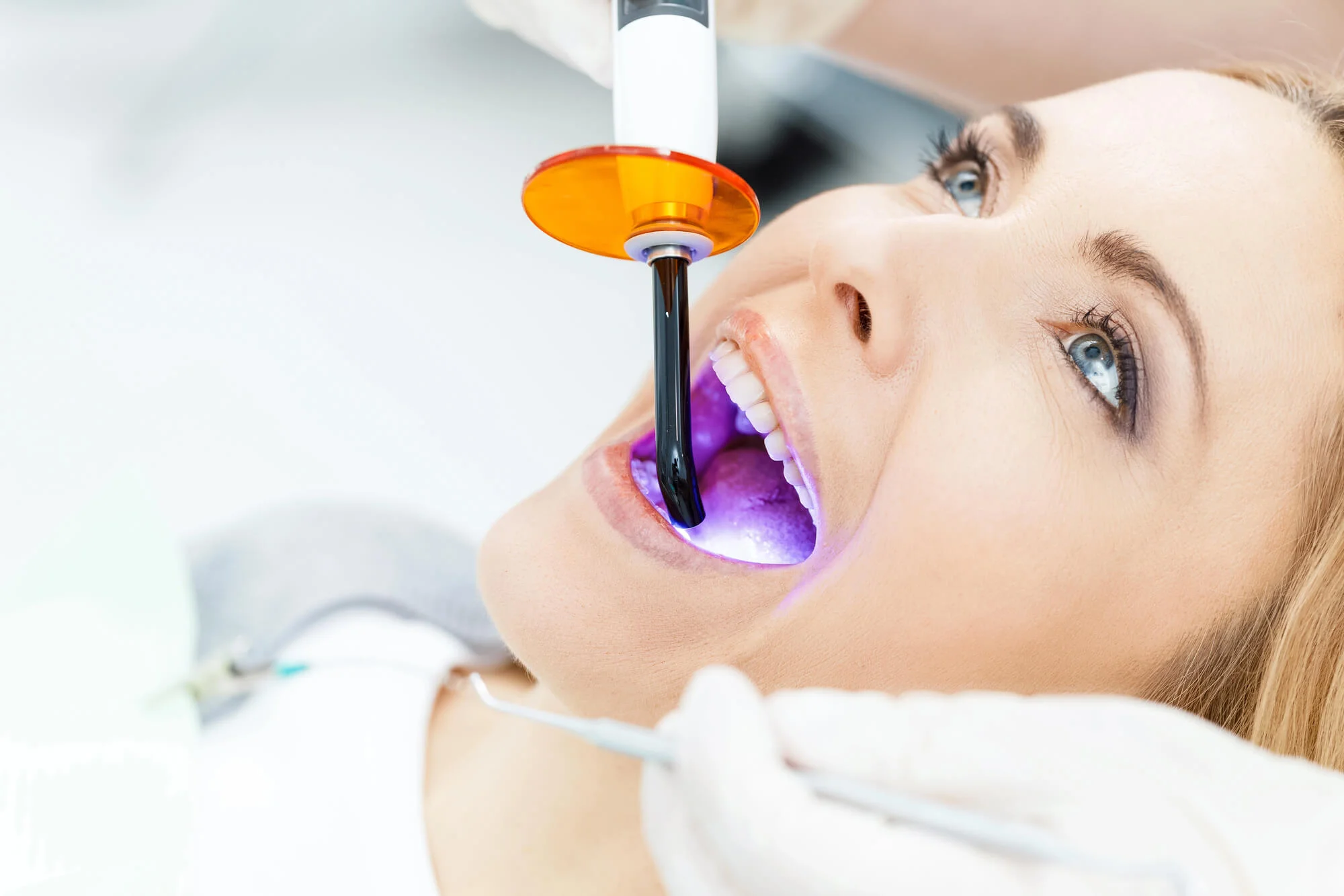 Patient Receiving Teeth Whitening In Plymouth.